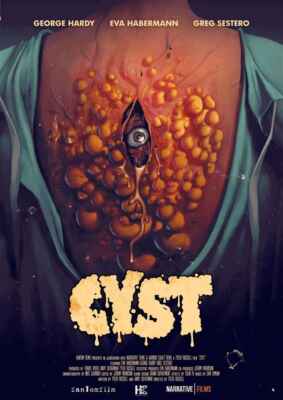 Cyst (Poster)